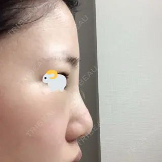 2日目の経過画像（2枚目）