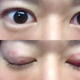 9日目の経過画像（1枚目）