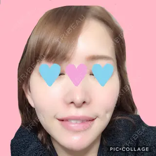 2日目の経過画像（1枚目）