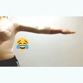 4日目の経過画像（1枚目）