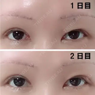 2日目の経過画像（1枚目）