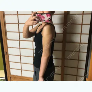 4日目の経過画像（2枚目）