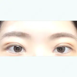 3日目の経過画像（1枚目）