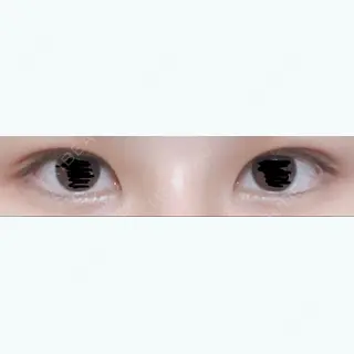 15日目の経過画像（1枚目）