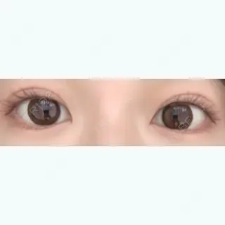 16日目の経過画像（1枚目）