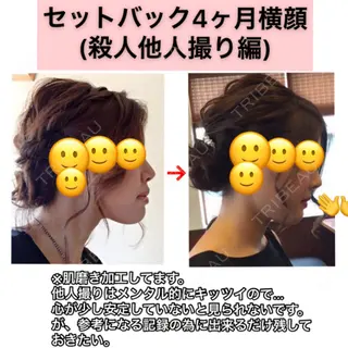 126日目の経過画像（1枚目）