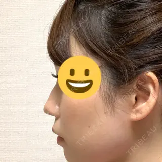 10日目の経過画像（1枚目）