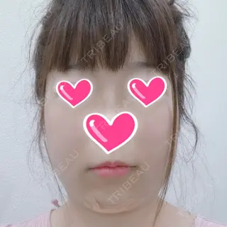 0日目の経過画像（1枚目）