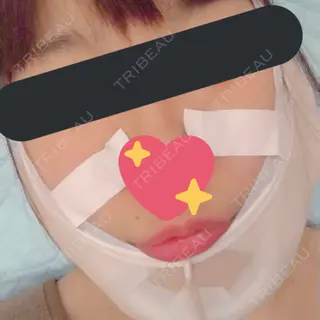 0日目の経過画像（2枚目）