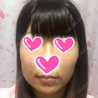 2日目の経過画像（1枚目）