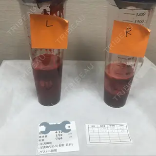 0日目の経過画像（1枚目）