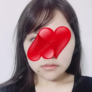 16日目の経過画像（1枚目）