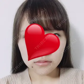 20日目の経過画像（1枚目）
