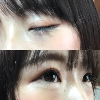 1日目の経過画像（2枚目）