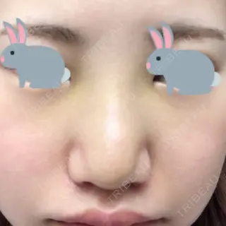 7日目の経過画像（1枚目）