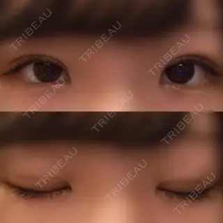 10日目の経過画像（2枚目）
