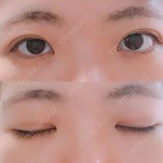 10日目の経過画像（1枚目）
