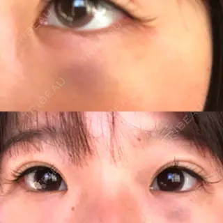 2日目の経過画像（1枚目）