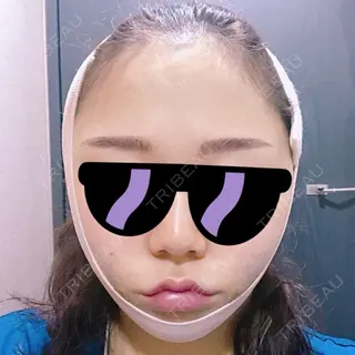 0日目の経過画像（1枚目）