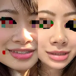 2日目の経過画像（2枚目）
