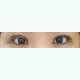 25日目の経過画像（1枚目）