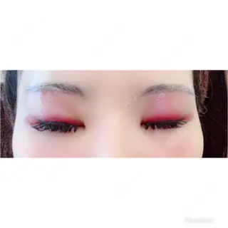 2日目の経過画像（1枚目）