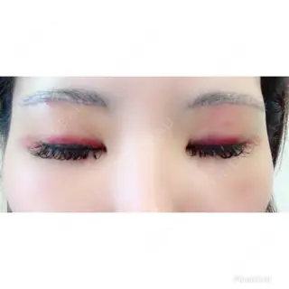 3日目の経過画像（1枚目）