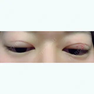 16日目の経過画像（2枚目）