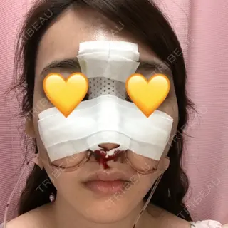 0日目の経過画像（1枚目）