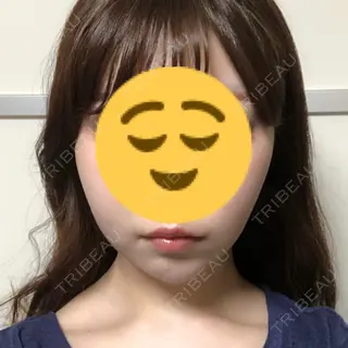 25日目の経過画像（1枚目）