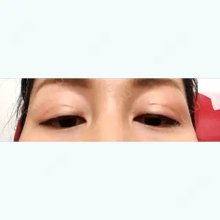 8日目の経過画像（2枚目）