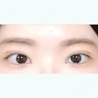 11日目の経過画像（1枚目）