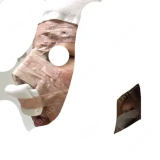 0日目の経過画像（2枚目）