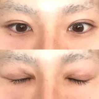 56日目の経過画像（1枚目）