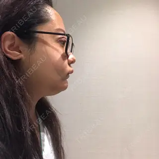 1日目の経過画像（1枚目）