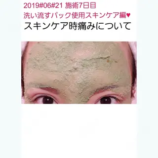 7日目の経過画像（1枚目）