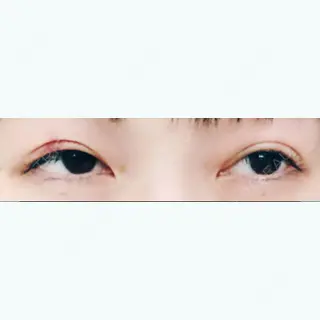 2日目の経過画像（1枚目）