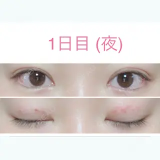 1日目の経過画像（2枚目）