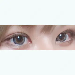 24日目の経過画像（1枚目）