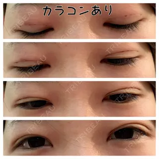 1日目の経過画像（1枚目）
