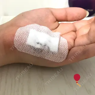 1日目の経過画像（2枚目）
