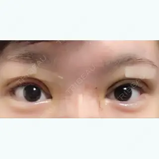 3日目の経過画像（1枚目）