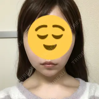 29日目の経過画像（1枚目）