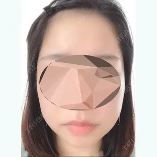 57日目の経過画像（1枚目）