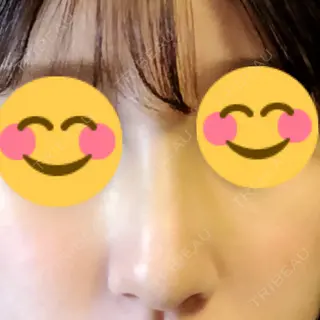 10日目の経過画像（2枚目）