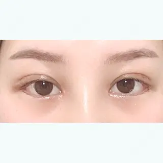 12日目の経過画像（1枚目）