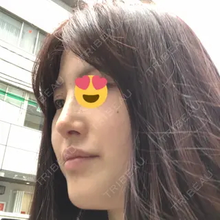 7日目の経過画像（1枚目）