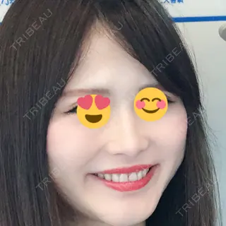 7日目の経過画像（1枚目）