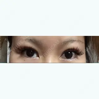 18日目の経過画像（1枚目）
