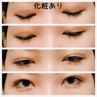 4日目の経過画像（1枚目）